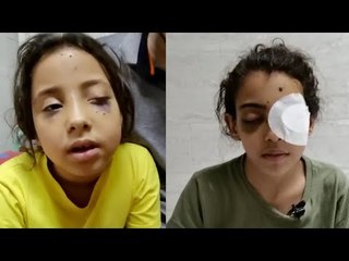 «عيار خرطوش» .. تفاصيل إصابة 6 أطفال بالعمى في حفل زفاف بالقليوبية