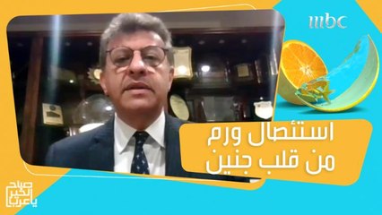 طبيب سعودي ينجح في استئصال ورم من قلب جنين في رحم أمه!