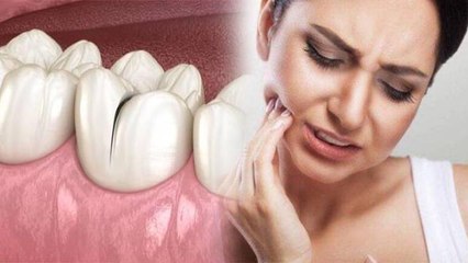 दांत में झनझनाहट हो तो क्या करना चाहिए, Root Canal से लेकर Gum Seal करना | Boldsky