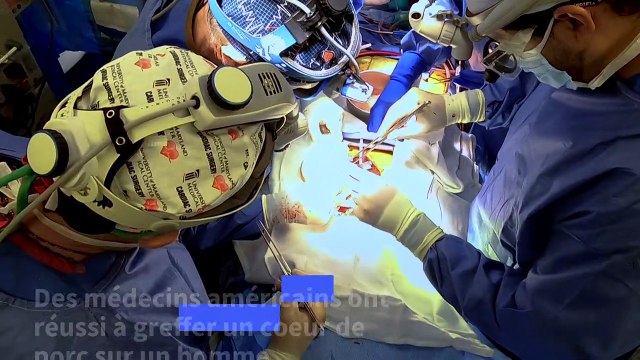Des chirurgiens américains ont greffé avec succès le coeur d'un porc sur un humain