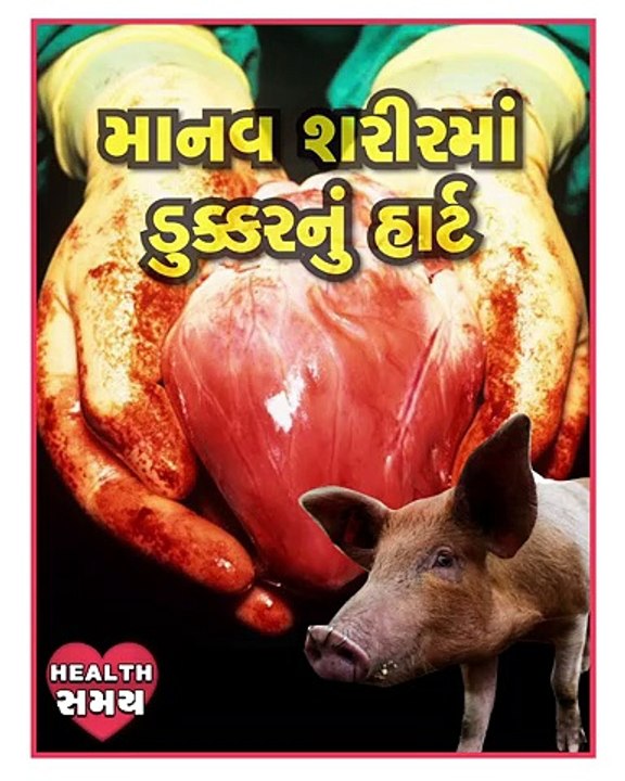 માનવ શરીરમાં ડુક્કરનું હાર્ટ