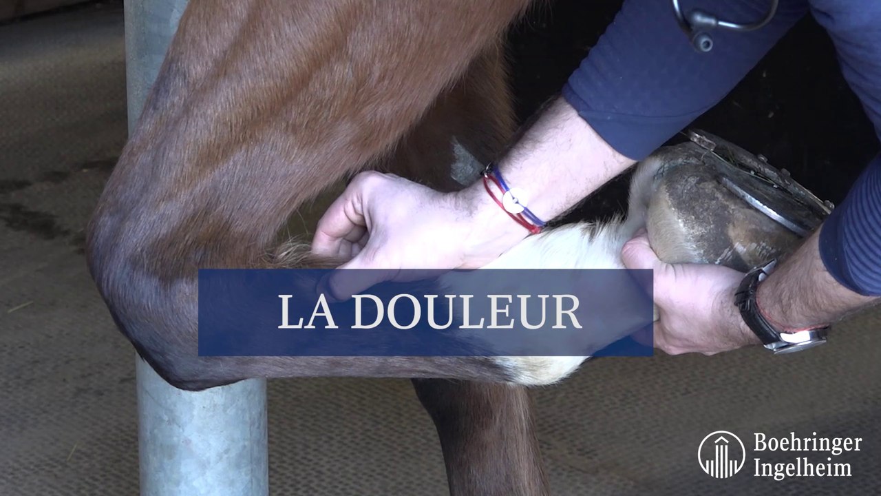 La douleur