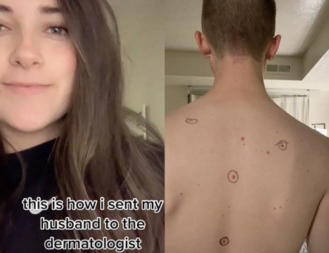 Elle envoie son mari chez le dermato avec de curieuses inscriptions sur le corps
