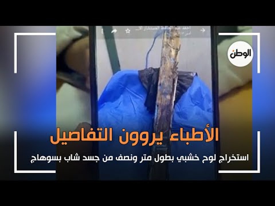 استخراج لوح خشبي بطول متر ونصف من جسد شاب بسوهاج