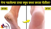 भेगा पडलेल्या टाचांपासून मिळवा सुटका | How to Get Rid of Crack Heels at Home cracked heels treatment