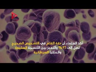 قلم يكتشف السرطان في 10 ثوانٍ فقط 🩺