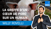 La greffe d’un cœur de porc sur un humain - Le billet de Willy Rovelli