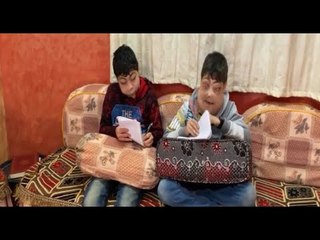 مدبولي يكلف وزارة الصحة بعلاج طفلي تنمر الدقهلية المصابين بتضخم الوجه