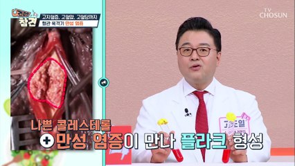 만병의 근원 ‘만성 염증’이 부르는 각종 질환은? TV CHOSUN 20220114 방송
