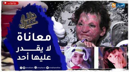 دلال خير: قصة مؤثرة لعائلة فقدت إثينين من أفرادها في حادثة مأساوية وبقيت طفلة تحمل آثارا لا تمحى