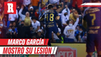Así quedo la pierna de Marco García a consecuencia de la lesión