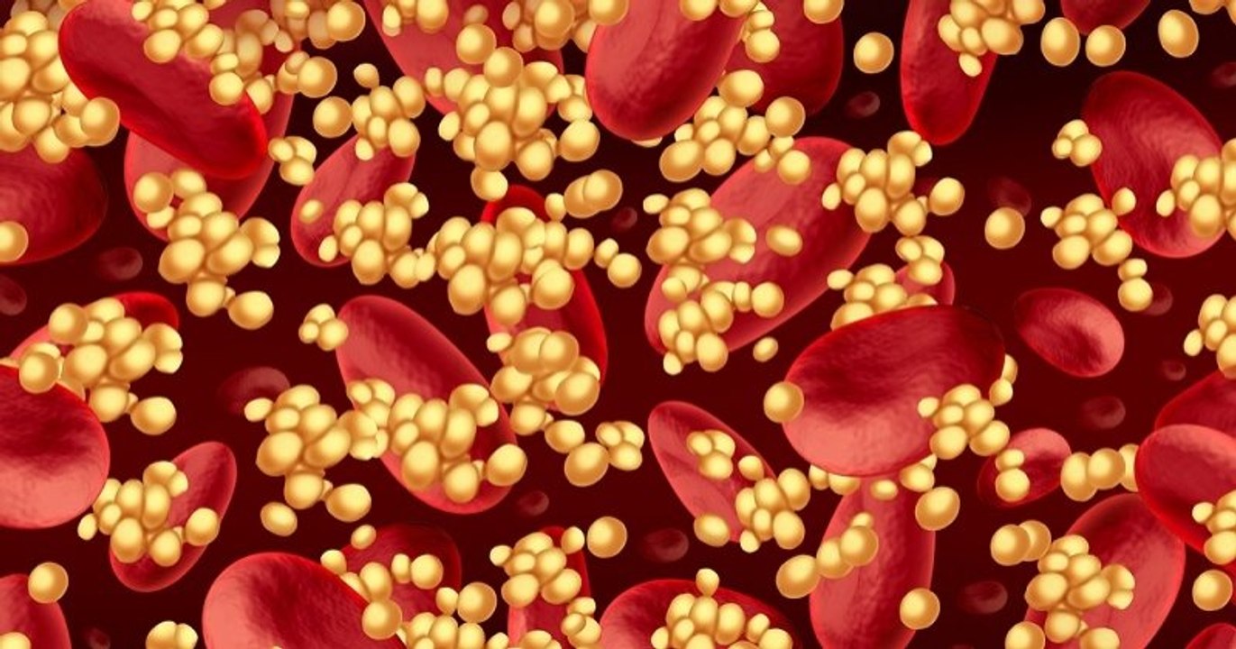 Le virus d'Epstein-Barr a été identifié comme étant à l'origine de la sclérose en plaques