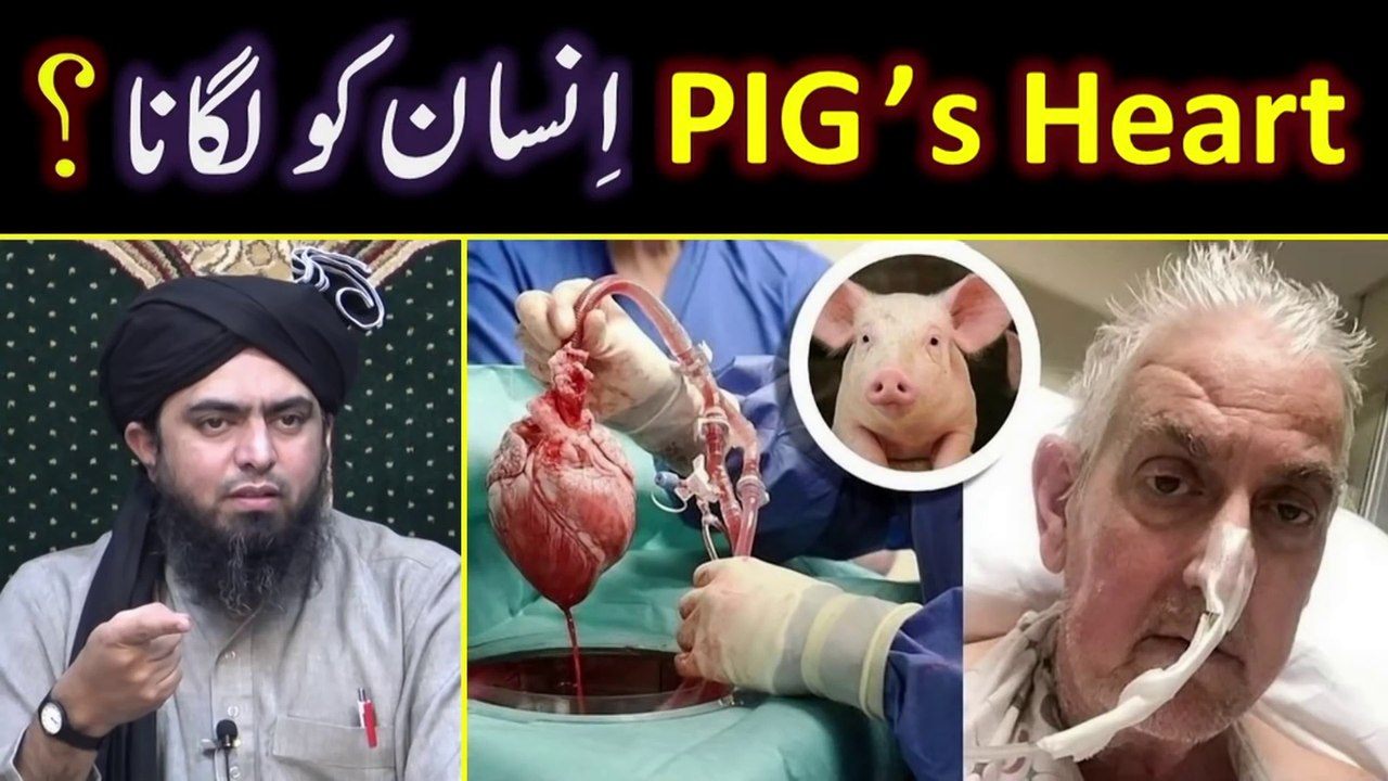 PIG's Heart in a Human Body --- Organ & Blood Donation is ISLAM --- By Engineer Muhammad Ali Mirza