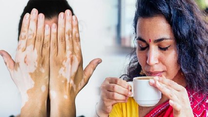 चाय पीने के बाद इस 1 चीज को खाने से सफेद दाग का खतरा | Boldsky