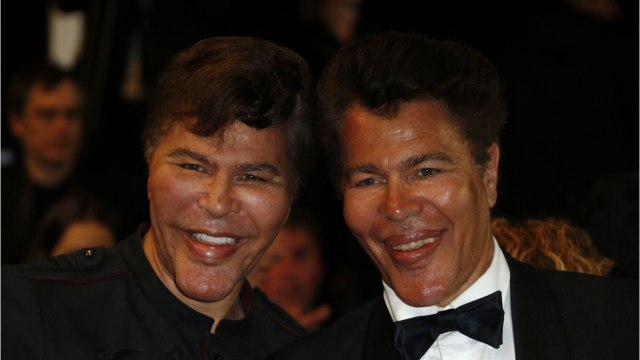 GALA VIDEO - EXCLU – Mort d’Igor et Grichka Bogdanoff : pourquoi leur frère a renoncé à les raisonner sur le vaccin