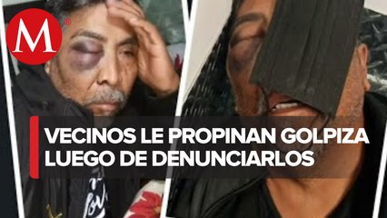 En Iztapalapa Rafael fue agredido por sus vecinos al denunciarlos por atropellar a 3 mujeres