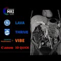LAVA is a 3D, FSPGR imaging technique that is based on a 3 dimensional spoiled gradient echo pulse sequence with fat suppression. LAVA & VIBE sequences are very useful for the evaluation of abdomen ,soft tissue and vascular imaging.