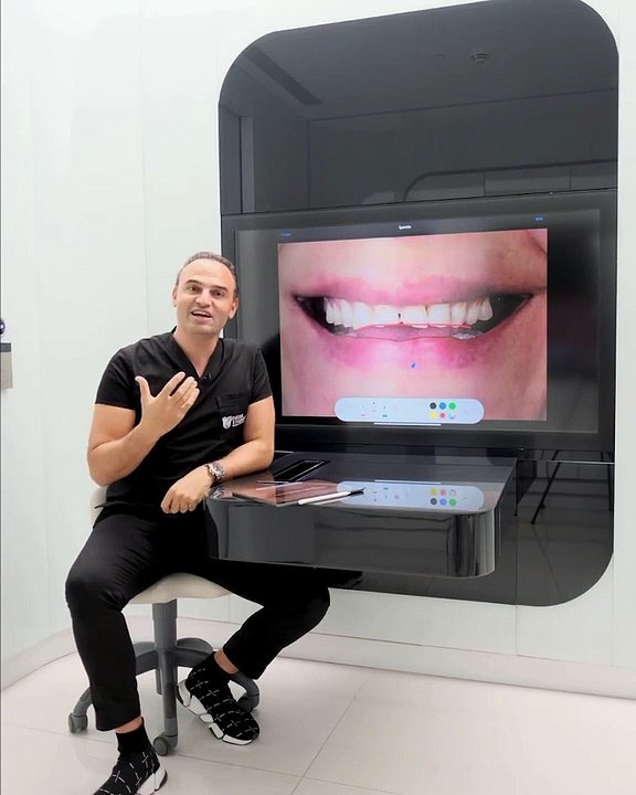 Estetik Gülüş Tasarımında Nelere Dikkat Edilmelidir?