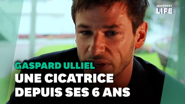 Gaspard Ulliel et sa cicatrice, l'histoire derrière cette marque qui faisait partie de lui