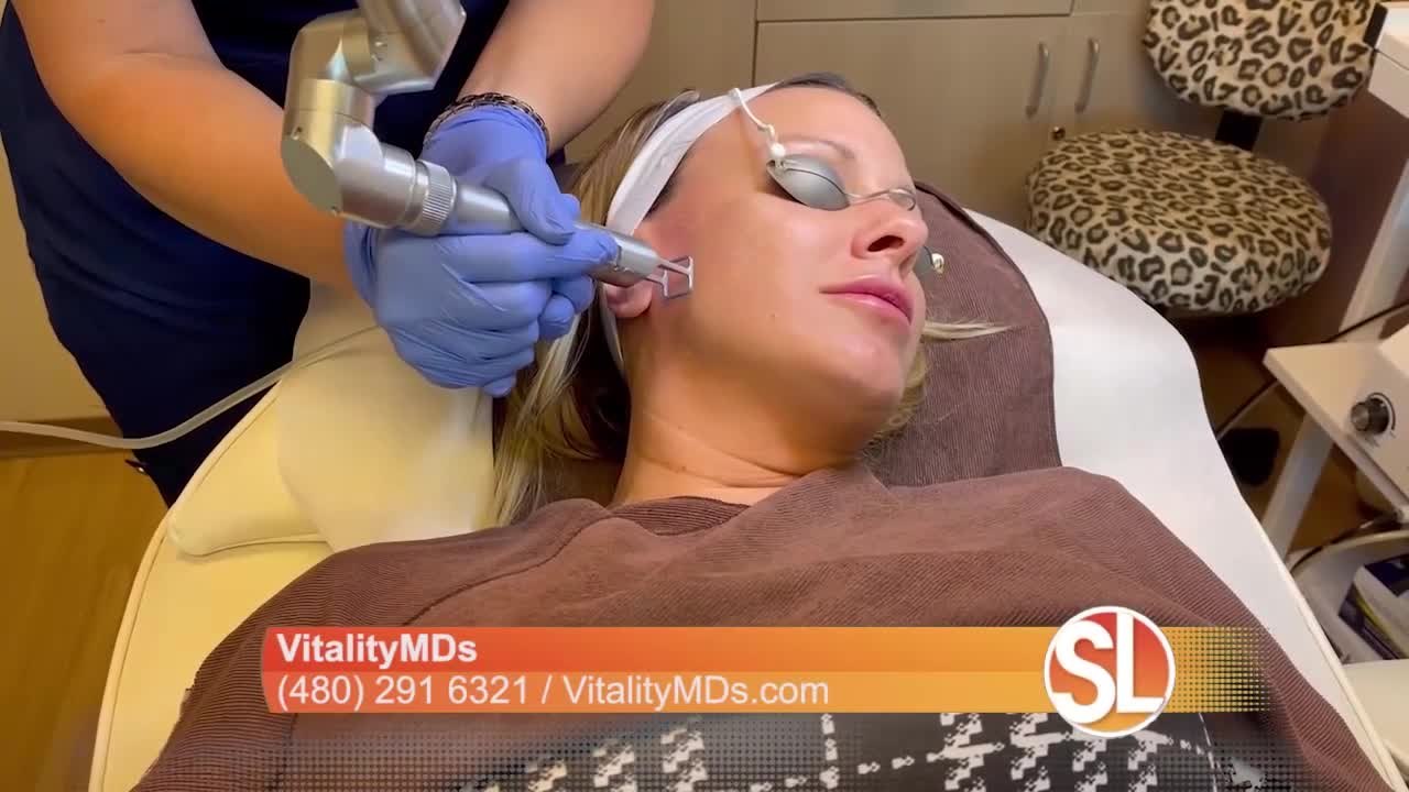 Vitality Laser Facial is now available at VitalityMDs Aesthetics
