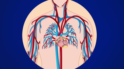 Trombosis venosa profunda: ¿Cómo identificarla? | Salud180