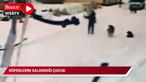 Kars’ta dehşet anları kamerada, çocuğun cesareti köpeklerin saldırısını önledi