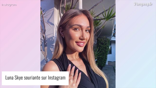 Luna Skye (Les Marseillais) a frôlé la mort : son chirurgien se défend, une autre star de télé-réalité infectée