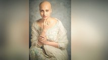 Breast Cancer से जंग लड़ रही South Actress Hamsa Nandini, Bold Photoshoot से मचाया धमाल | Boldsky