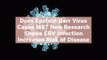 Does Epstein-Barr Virus Cause MS? New Research Shows EBV Infection Increases Risk of Disease