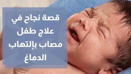 قصة نجاح في علاج طفل مصاب بإلتهاب حاد في الدماغ