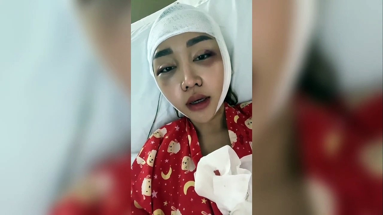 Ongkos Operasi Wajah Setara Tiga Ekor Kerbau, Lucinta Luna Mulai Pede Meski Masih Bengkak