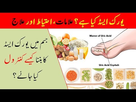 Uric Acid Treatment | Uric Acid Ka Fori Ilaj | Uric Acid Kya Hay