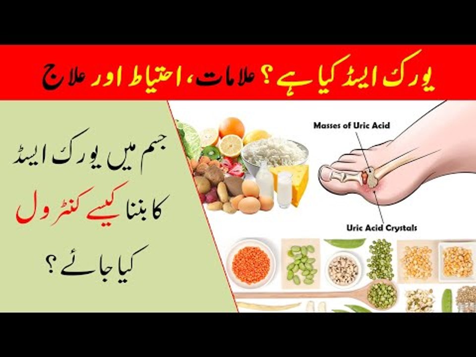 Uric Acid Treatment | Uric Acid Ka Fori Ilaj | Uric Acid Kya Hay