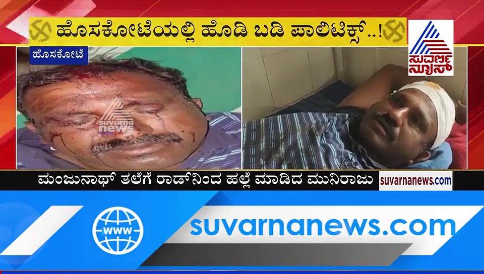 ಹೊಸಕೋಟೆಯಲ್ಲಿ ರಕ್ತ ರಾಜಕೀಯ! MTB ಬೆಂಬಲಿಗನ ಮೇಲೆ ಹಲ್ಲೆ