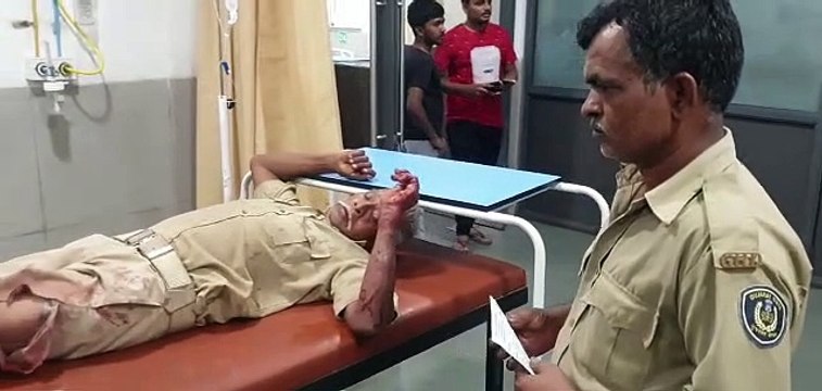 Gujarat News : दाहोद शहर में श्वानों का आतंक, राजकोट में पालने में सो रहे बालक को काटा, मौत