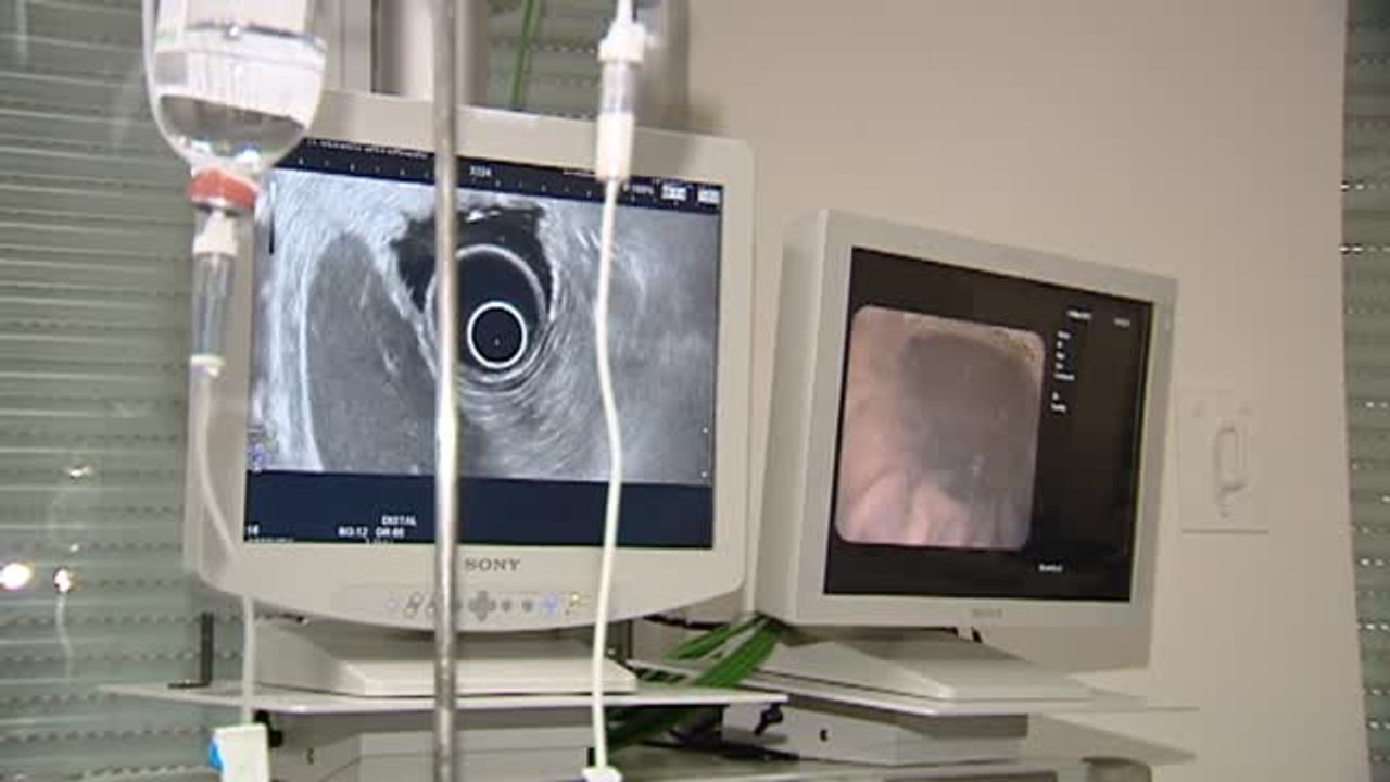 Un fármaco logra que remita el cáncer de colon en un grupo completo de pacientes