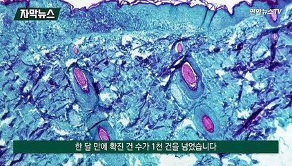 [자막뉴스] 코로나도 골치인데 원숭이두창·뎅기열 확산…각국 비상
