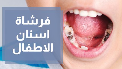هل فرشاة الأسنان تكفي للحماية من التسوس؟