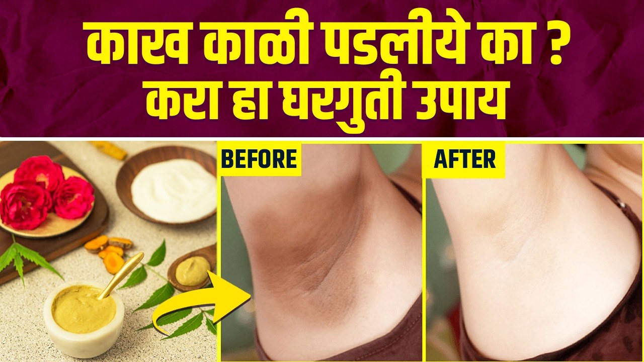 काळवंडलेल्या अंडरआर्म्ससाठी करा हा घरगुती उपाय | How to Get Rid of Dark Underarms | Dark Underarms