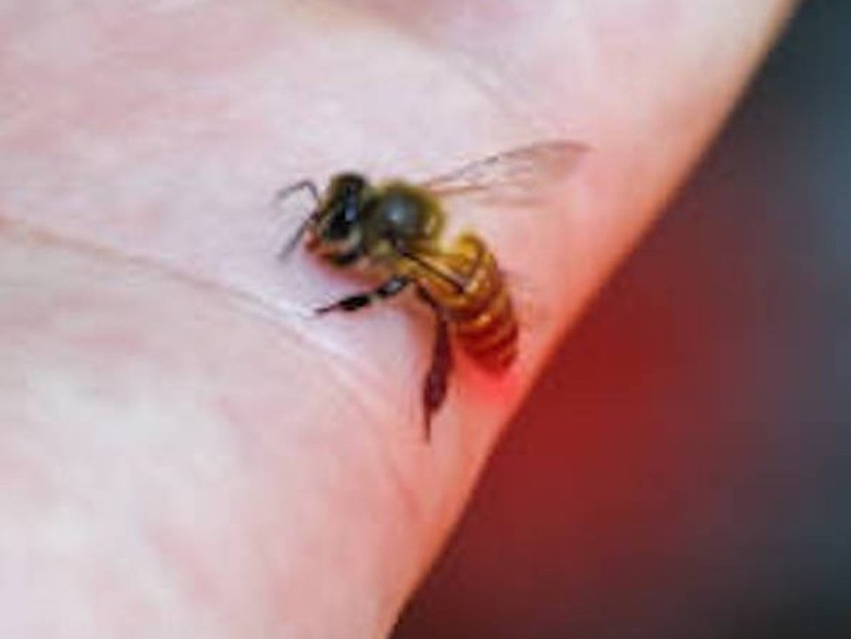 Bienen- oder Wespenstich? Das kannst du dagegen tun