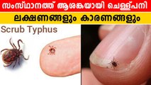 Causes Of Scrub Typhus Infection | ചെള്ള് പനി എങ്ങനെ തടയാം | *Kerala