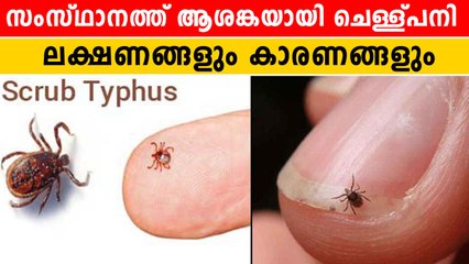 Causes Of Scrub Typhus Infection | ചെള്ള് പനി എങ്ങനെ തടയാം | *Kerala