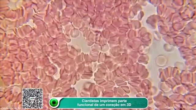 Coração impresso em 3D? Cientistas dão importante passo em pesquisa