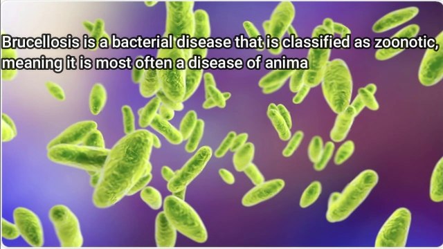 Brucellosis (rock fever, Bang's disease, Mediterranean fever, Maltese or Malta fever, undulant fever or Cyprus fever)