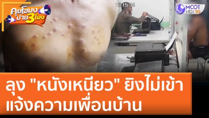 ลุง "หนังเหนียว" ยิงไม่เข้า แจ้งความเพื่อนบ้าน (10 มิ.ย. 65) คุยโขมงบ่าย 3 โมง