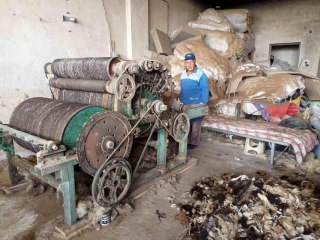 Elini kaybetti, yine de mesleğinden vazgeçmedi