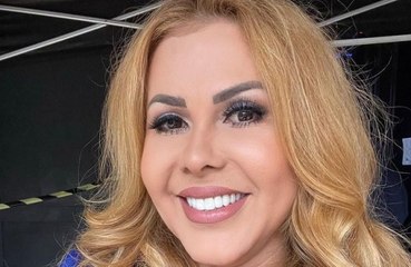 Joelma cancela shows após descobrir causa de inchaço no rosto