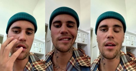 "Es bastante serio": Justin Bieber sufre parálisis facial debido a un virus con el que viene luchando