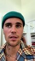Justin Bieber confesó que sufre de parálisis en la mitad del rostro por un virus