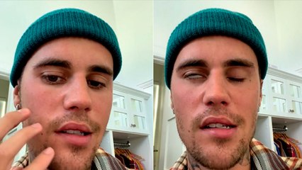 Justin Bieber को खतरनाक बीमारी, Face Paralysis Video किया Share । Boldsky । *Entertainment